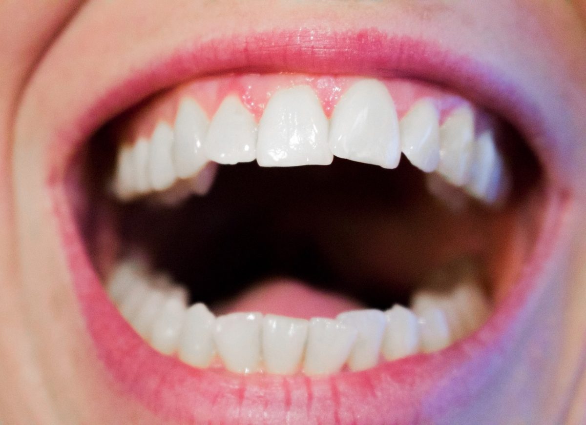 Dzisiejsza technika stosowana w salonach stomatologii estetycznej być może sprawić, że odbierzemy śliczny uśmiech.
